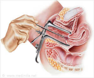 endometrial biopsy